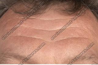 human skin wrinkled 0003